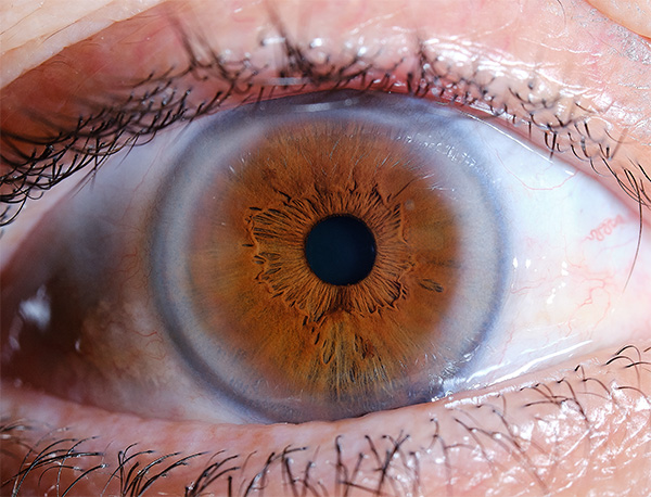 Pourquoi la couleur de vos iris s'estompe-t-elle avec l'âge ? Les secrets révélés par l'iris photo